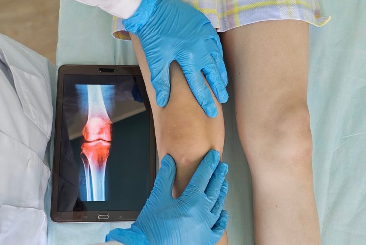 Doctor,Examining,Patients,Knee,With,X-ray,Image Doctor,Examining,Patients,Knee,With,X-ray,Image