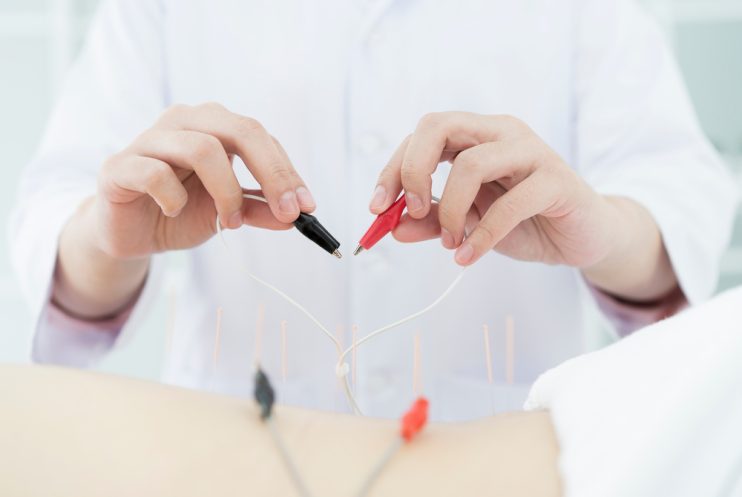 Hands,Doctor,With,Electro-acupuncture,Therapy,Holding,Heart,,Acupuncture,Can,Be