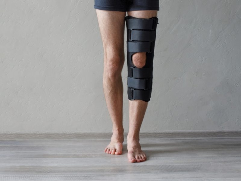 Patient,Standing,With,Knee,Brace,Support,After,Do,Posterior,Cruciate Patient,Standing,With,Knee,Brace,Support,After,Do,Posterior,Cruciate