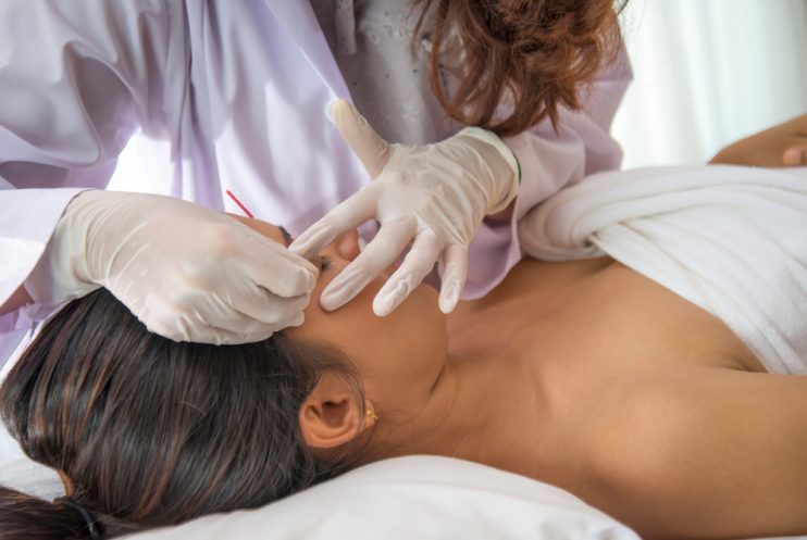 Woman,In,An,Acupuncture,Therapy,At,Beauty,Spa,Room,,Healthy