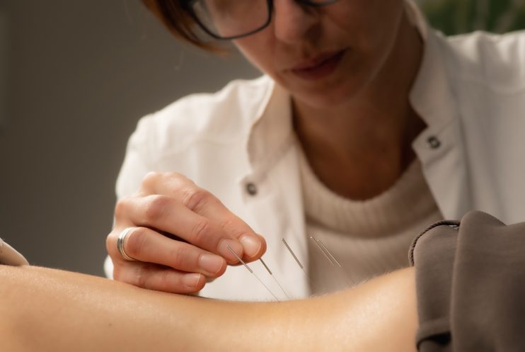 Acupunturist,Treating,Patient,Chronic,Back,Pain