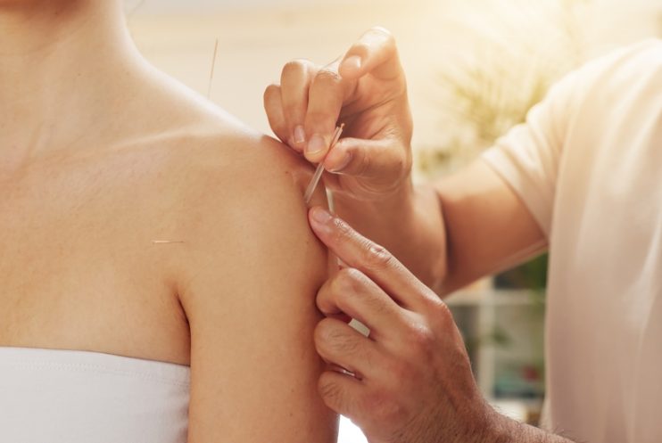 Acupuncture,,Holistic,And,Shoulder,In,Spa,With,Customer,Treatment,For
